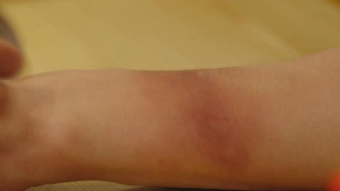 消えたゴッドシェフ：腕の傷が暴く、料理人としての「罪」と「救済」