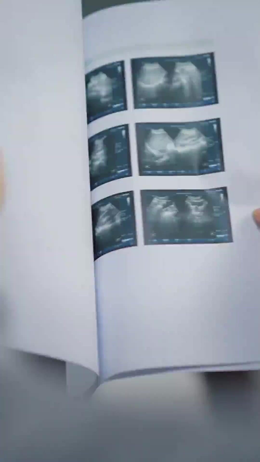 뼈에 새긴 사랑