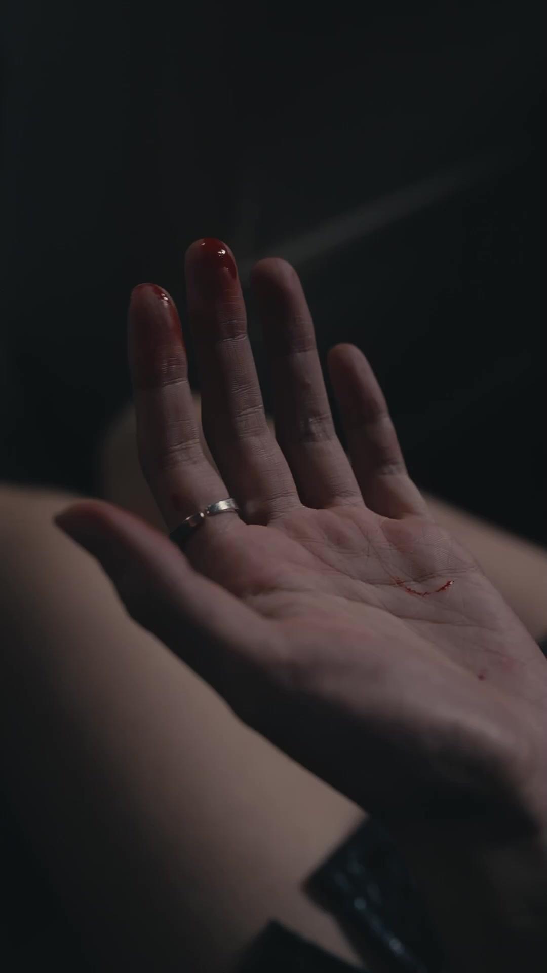 MEURTRE ACCIDENTEL, FUITE MORTELLE