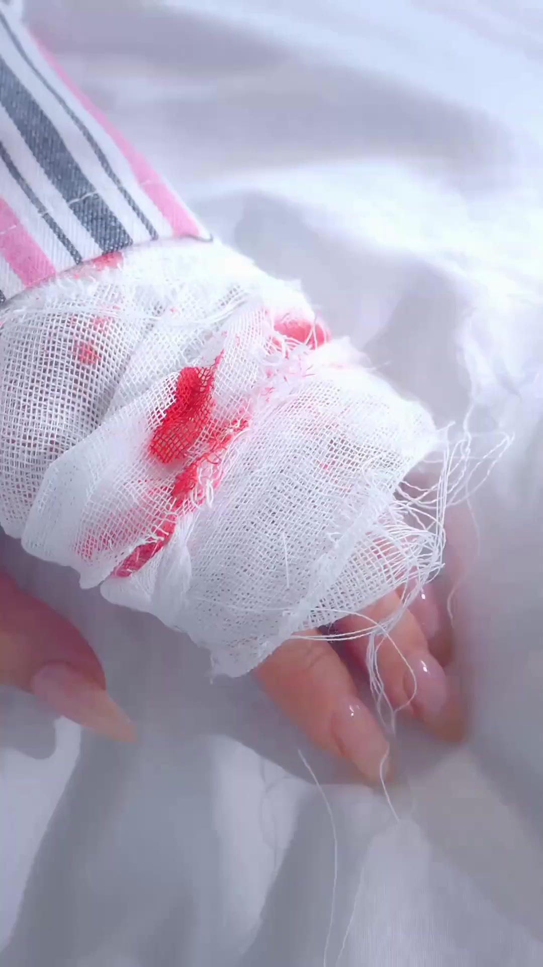 (Synchro) Ring fort, Krone zurück